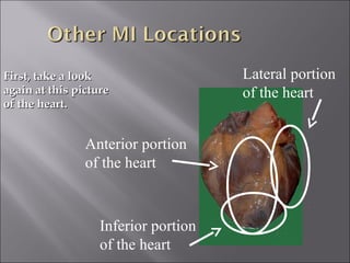 First, take a lookFirst, take a look
again at this pictureagain at this picture
of the heart.of the heart.
Anterior portion
of the heart
Lateral portion
of the heart
Inferior portion
of the heart
 