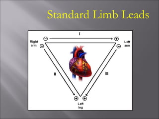 Standard Limb Leads
 