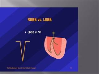 ECG BASICS IN DETAIL