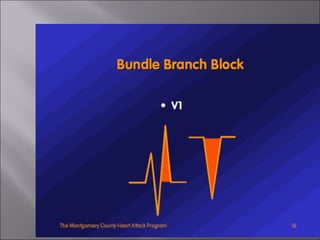 ECG BASICS IN DETAIL