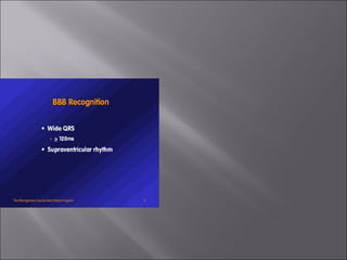 ECG BASICS IN DETAIL
