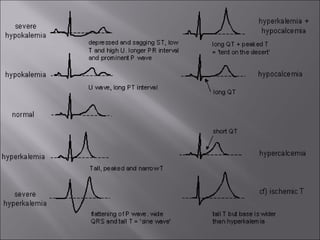 ECG BASICS IN DETAIL