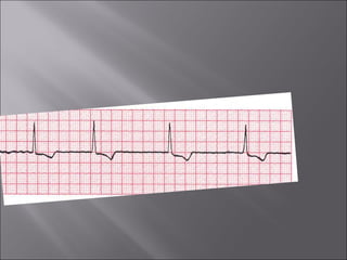 ECG BASICS IN DETAIL