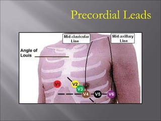 Precordial Leads
 