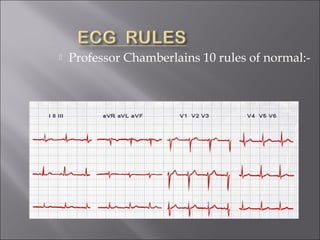  Professor Chamberlains 10 rules of normal:-
 