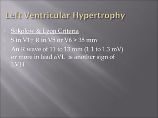  Sokolow & Lyon Criteria
 S in V1+ R in V5 or V6 > 35 mm
 An R wave of 11 to 13 mm (1.1 to 1.3 mV)
or more in lead aVL is another sign of
LVH
 