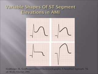 Goldberger AL. Goldberger: Clinical Electrocardiography: A Simplified Approach. 7th
ed: Mosby Elsevier; 2006.
 
