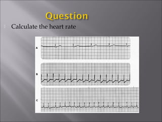  Calculate the heart rate
 