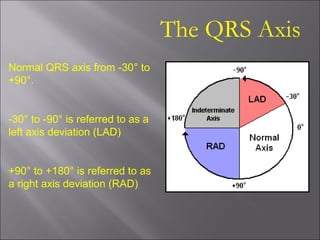 The QRS Axis
Normal QRS axis from -30° to
+90°.
-30° to -90° is referred to as a
left axis deviation (LAD)
+90° to +180° is referred to as
a right axis deviation (RAD)
 