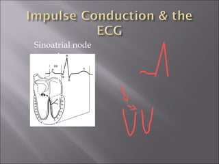 Sinoatrial node
AV node
Bundle of His
Bundle Branches
 