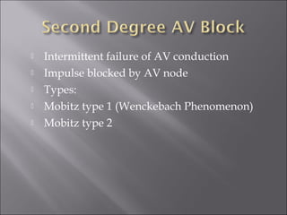  Intermittent failure of AV conduction
 Impulse blocked by AV node
 Types:
 Mobitz type 1 (Wenckebach Phenomenon)
 Mobitz type 2
 