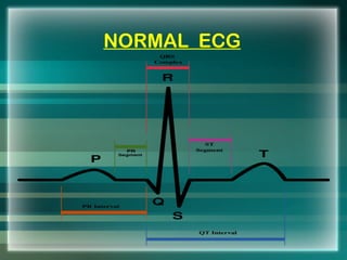 NORMAL ECG
 