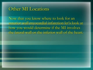 Other MI Locations
Other MI Locations
Now that you know where to look for an
Now that you know where to look for an
anterior wall myocardial infarction let’s look at
anterior wall myocardial infarction let’s look at
how you would determine if the MI involves
how you would determine if the MI involves
the lateral wall or the inferior wall of the heart.
the lateral wall or the inferior wall of the heart.
 