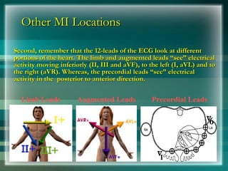 Other MI Locations
Other MI Locations
Second, remember that the 12-leads of the ECG look at different
Second, remember that the 12-leads of the ECG look at different
portions of the heart. The limb and augmented leads “see” electrical
portions of the heart. The limb and augmented leads “see” electrical
activity moving inferiorly (II, III and aVF), to the left (I, aVL) and to
activity moving inferiorly (II, III and aVF), to the left (I, aVL) and to
the right (aVR). Whereas, the precordial leads “see” electrical
the right (aVR). Whereas, the precordial leads “see” electrical
activity in the posterior to anterior direction.
activity in the posterior to anterior direction.
Limb Leads Augmented Leads Precordial Leads
 