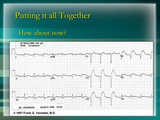 Putting it all Together
Putting it all Together
How about now?
How about now?
 