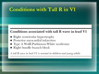 Conditions with Tall R in V1
 