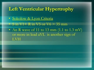 Left Ventricular Hypertrophy
• Sokolow & Lyon Criteria
• S in V1+ R in V5 or V6 > 35 mm
• An R wave of 11 to 13 mm (1.1 to 1.3 mV)
or more in lead aVL is another sign of
LVH
 