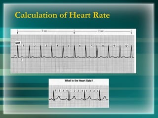 Calculation of Heart Rate
 
