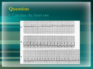 Question
• Calculate the heart rate
 