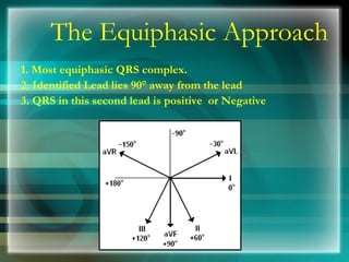 The Equiphasic Approach
1. Most equiphasic QRS complex.
2. Identified Lead lies 90° away from the lead
3. QRS in this second lead is positive or Negative
 