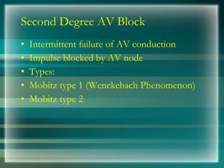 Second Degree AV Block
• Intermittent failure of AV conduction
• Impulse blocked by AV node
• Types:
• Mobitz type 1 (Wenckebach Phenomenon)
• Mobitz type 2
 