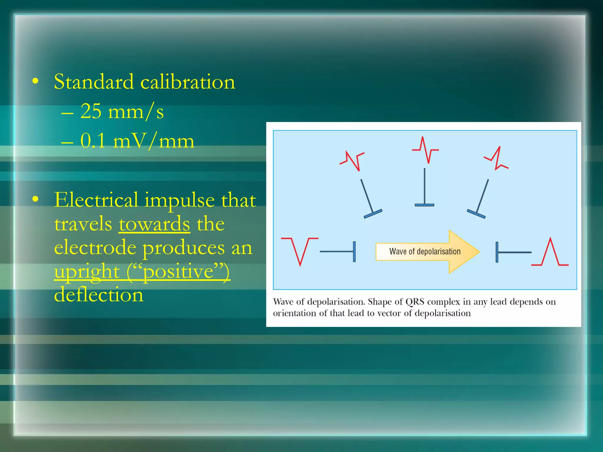Standard calibration 25 mm/s 0.1 mV/mm Electrical impulse that travels  towards  the electrode produces an  upright (“positive”)  deflection 