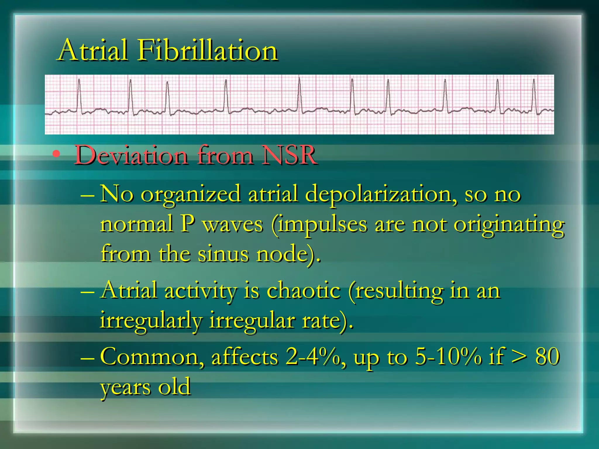Atrial Fibrillation Deviation from NSR No organized atrial depolarization, so no normal P waves (impulses are not originating from the sinus node). Atrial activity is chaotic (resulting in an irregularly irregular rate). Common, affects 2-4%, up to 5-10% if > 80 years old 