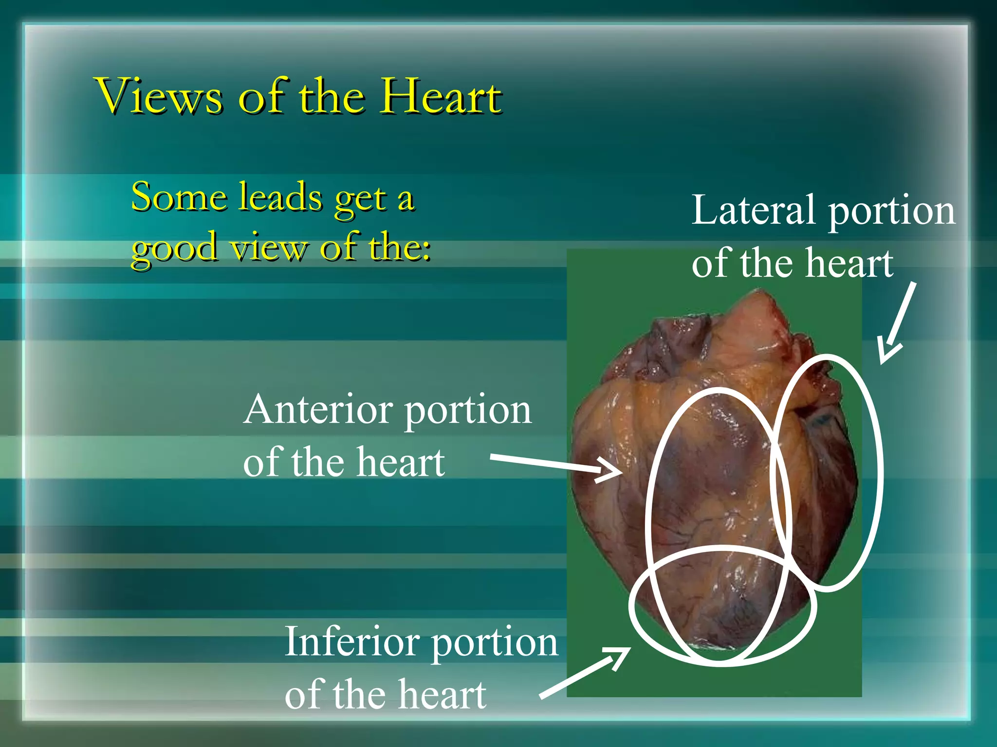 Views of the Heart Some leads get a good view of the: Anterior portion of the heart Lateral portion of the heart Inferior portion of the heart 
