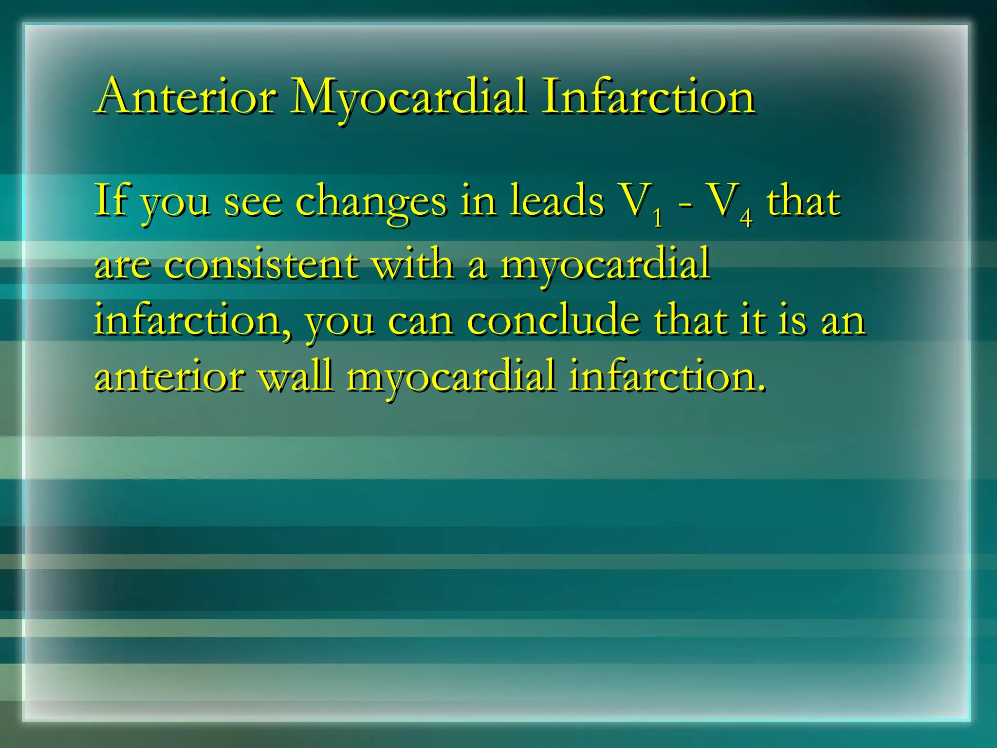 Anterior Myocardial Infarction If you see changes in leads V 1  - V 4  that are consistent with a myocardial infarction, you can conclude that it is an anterior wall myocardial infarction. 
