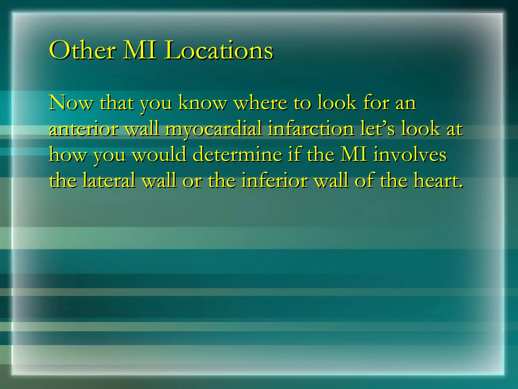 Other MI Locations Now that you know where to look for an anterior wall myocardial infarction let’s look at how you would determine if the MI involves the lateral wall or the inferior wall of the heart. 