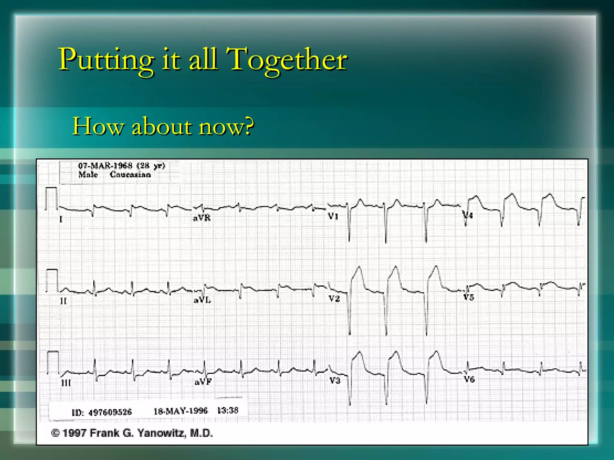 Putting it all Together How about now? 