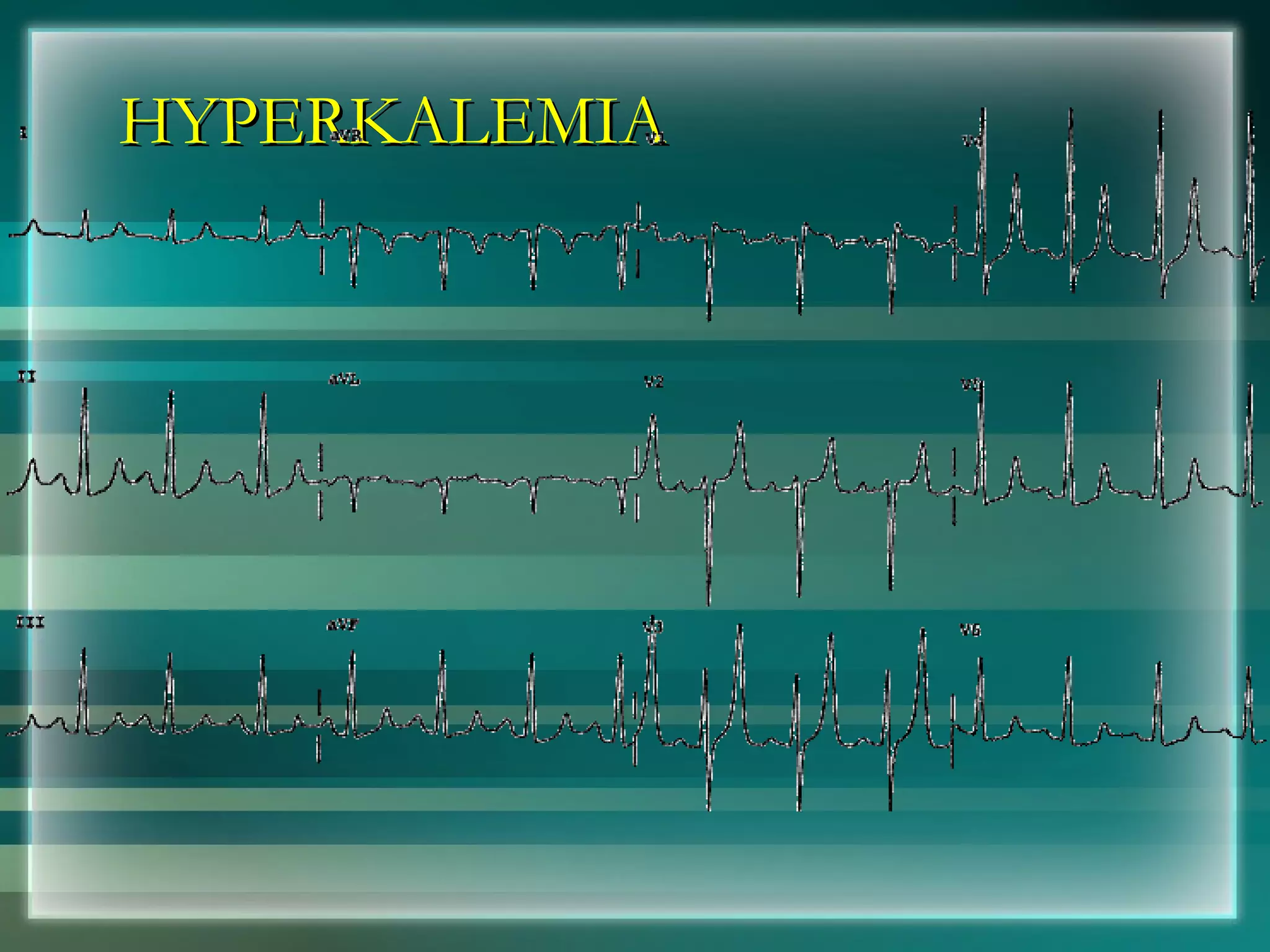 HYPERKALEMIA 