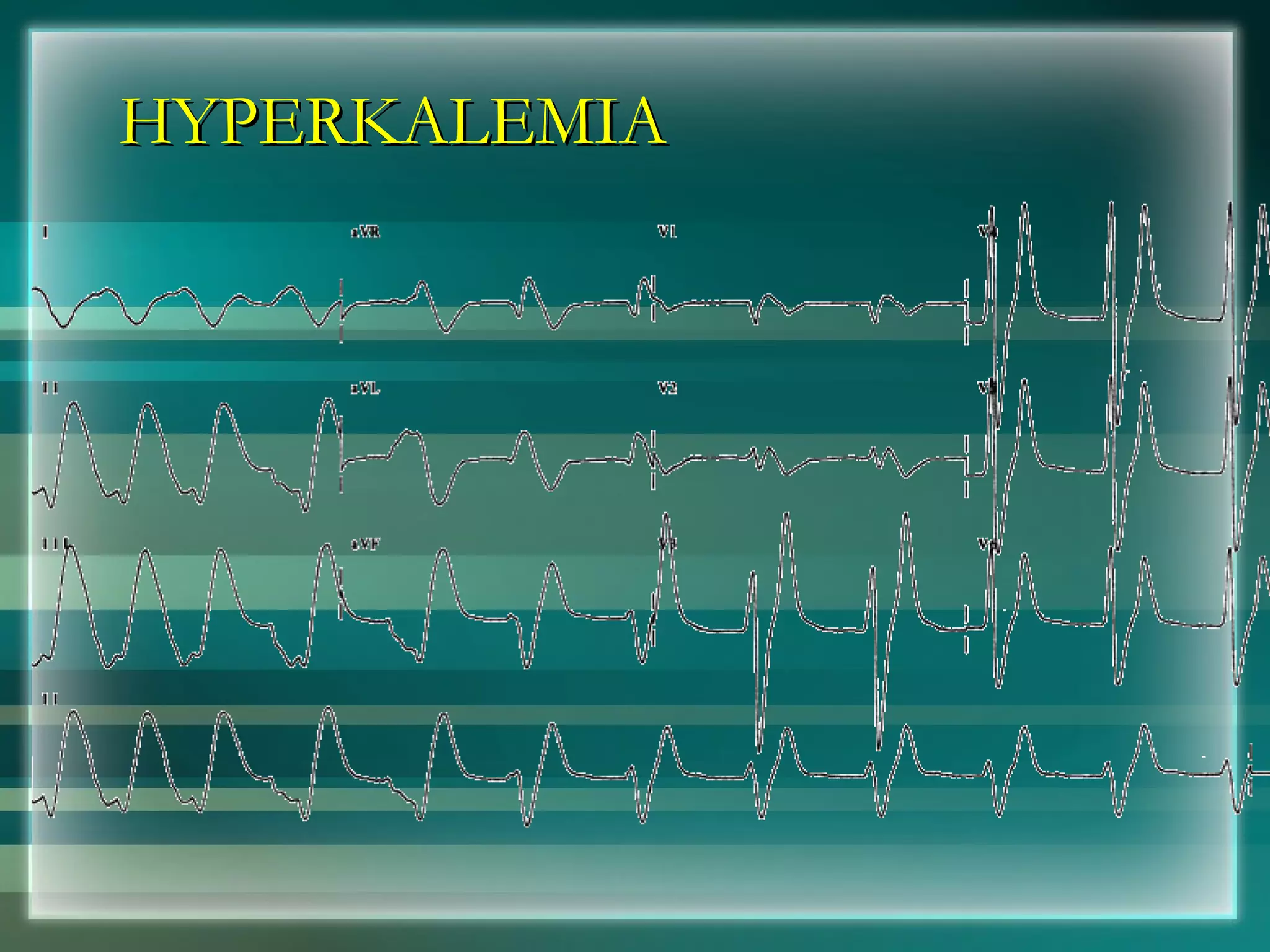 HYPERKALEMIA 