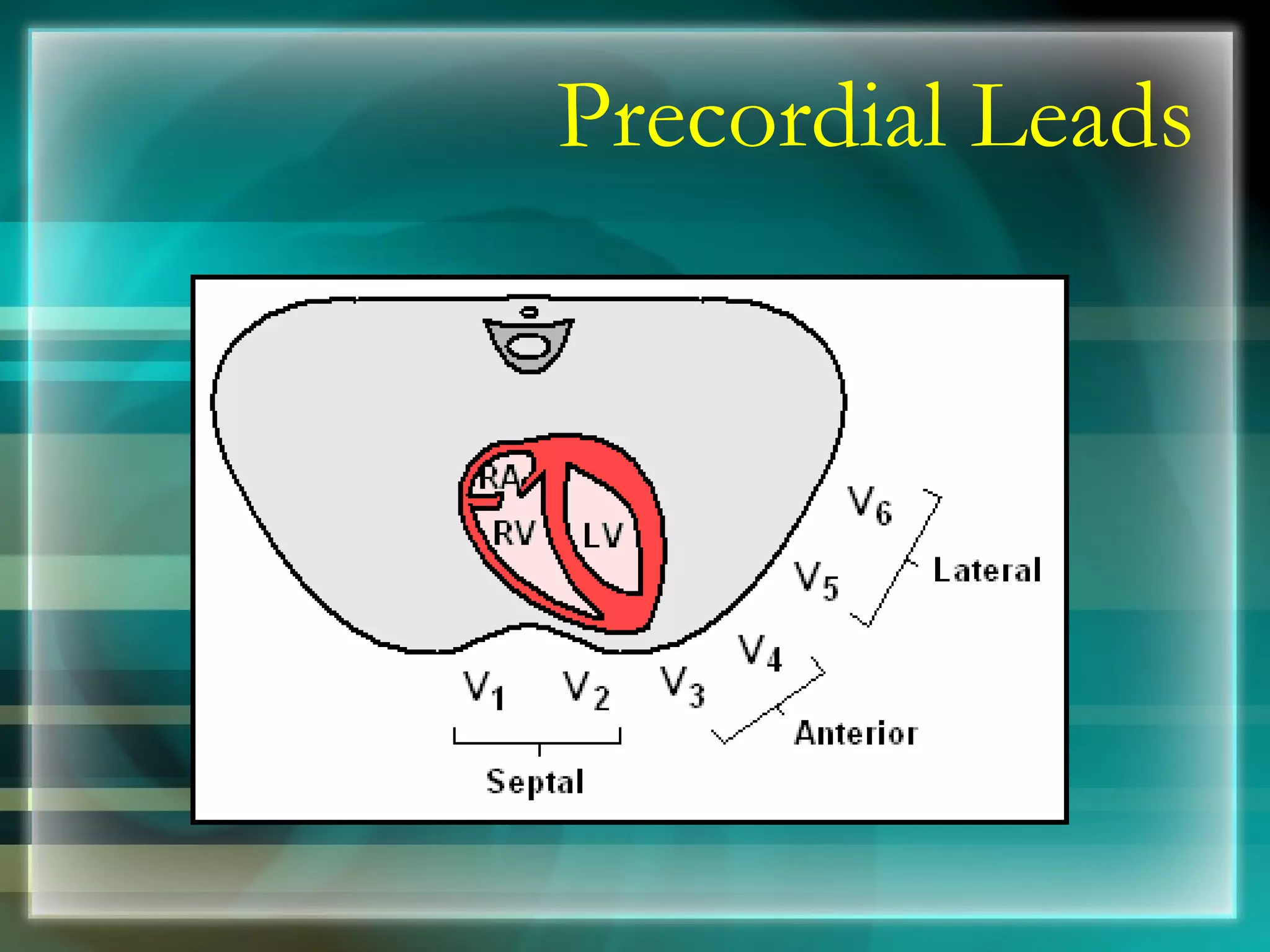 Precordial Leads 