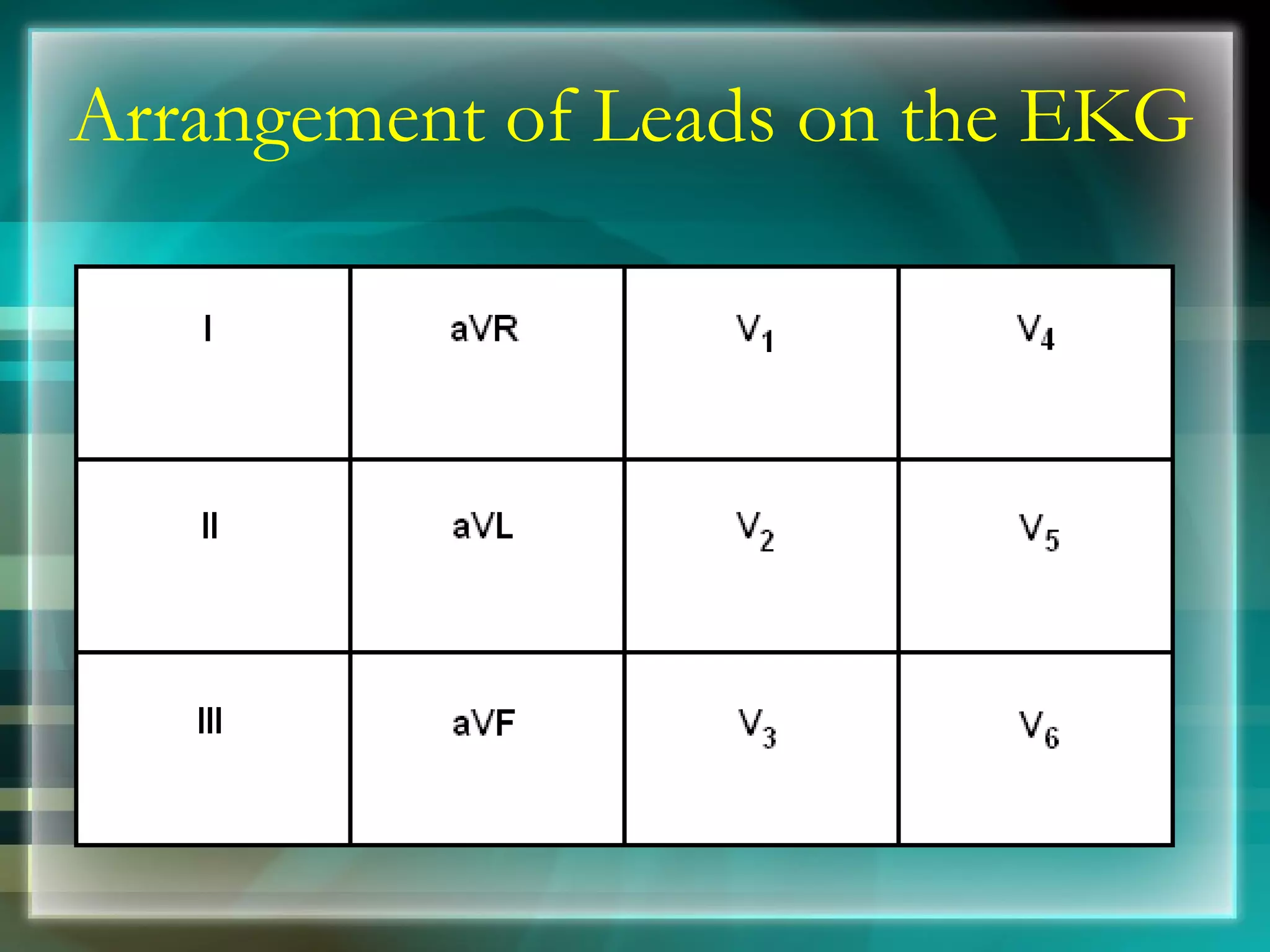 Arrangement of Leads on the EKG 