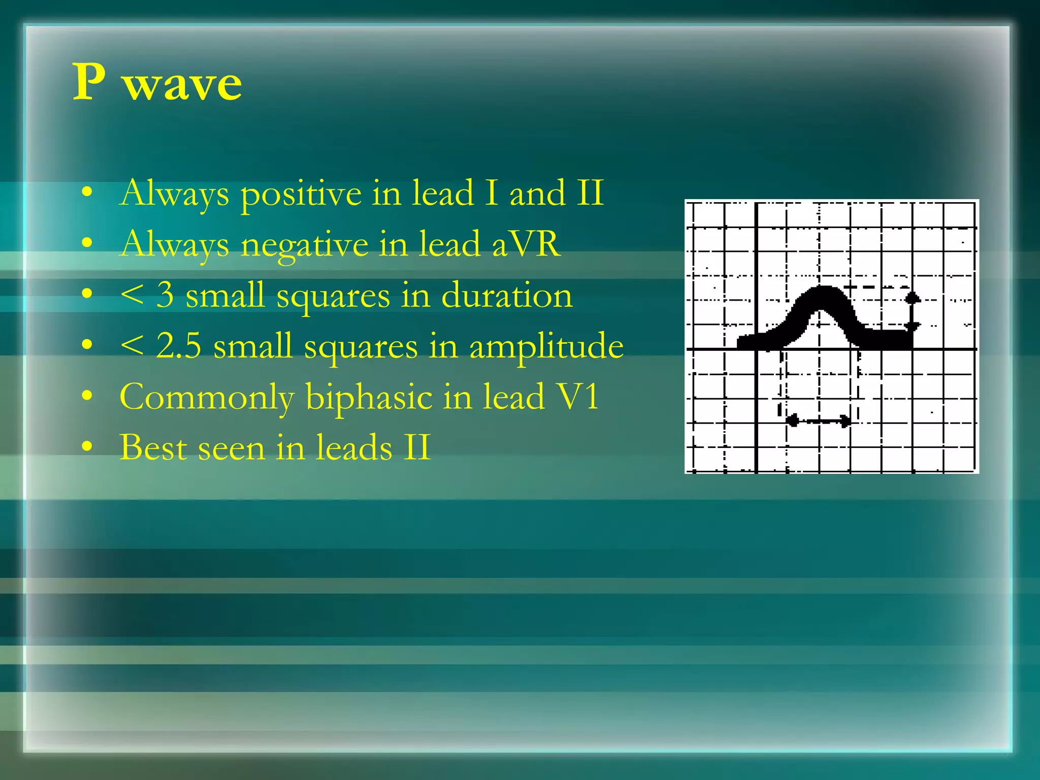 P wave Always positive in lead I and II  Always negative in lead aVR  < 3 small squares in duration < 2.5 small squares in amplitude Commonly biphasic in lead V1  Best seen in leads II 