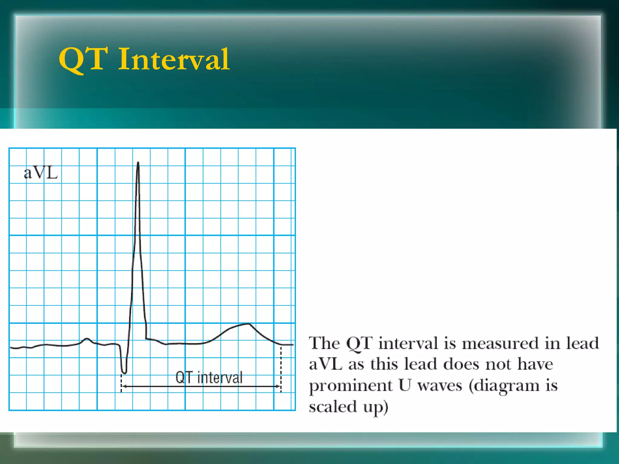 QT Interval 