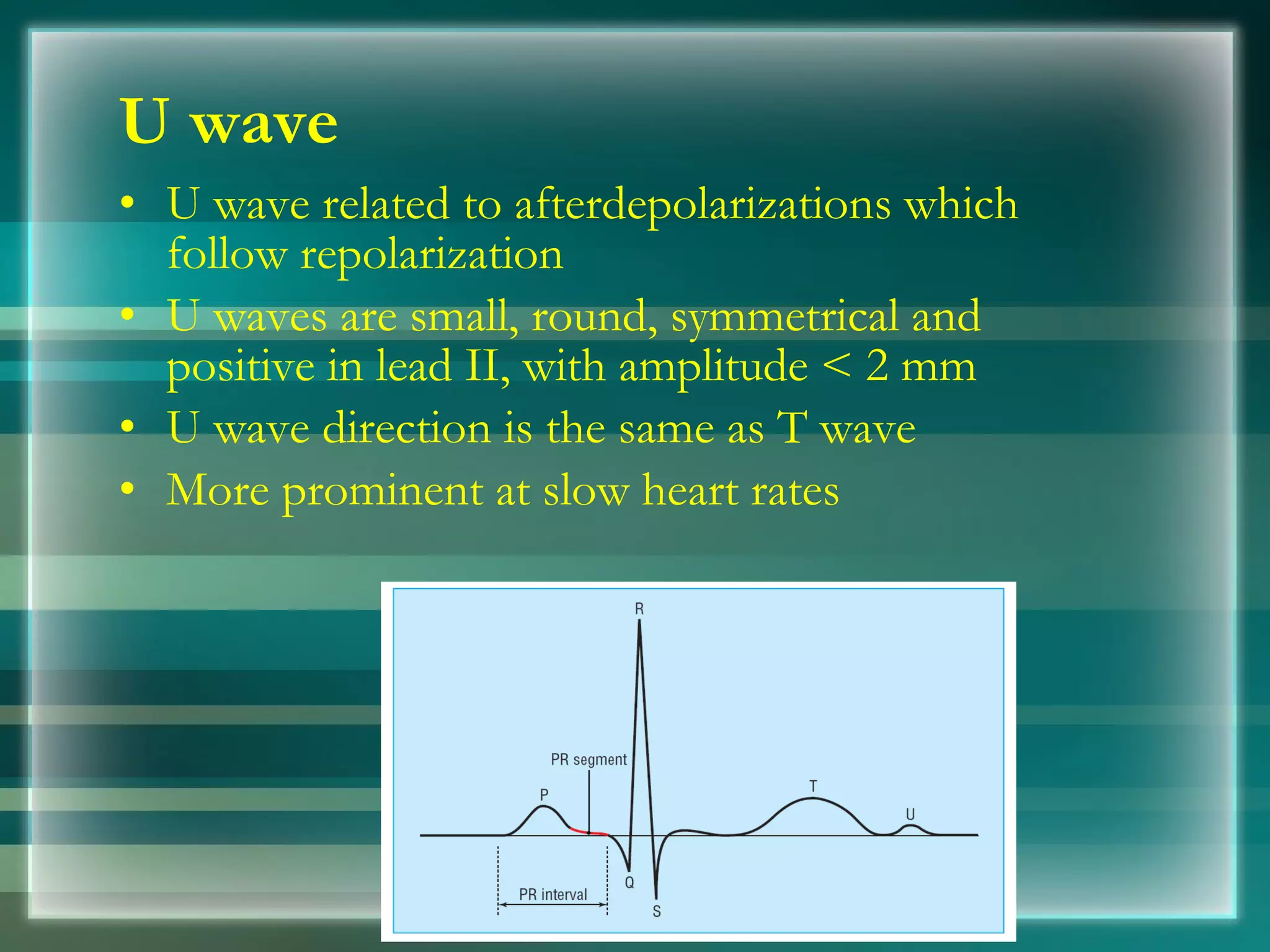 U wave U wave related to afterdepolarizations which follow repolarization U waves are small, round, symmetrical and positive in lead II, with amplitude < 2 mm  U wave direction is the same as T wave  More prominent at slow heart rates  