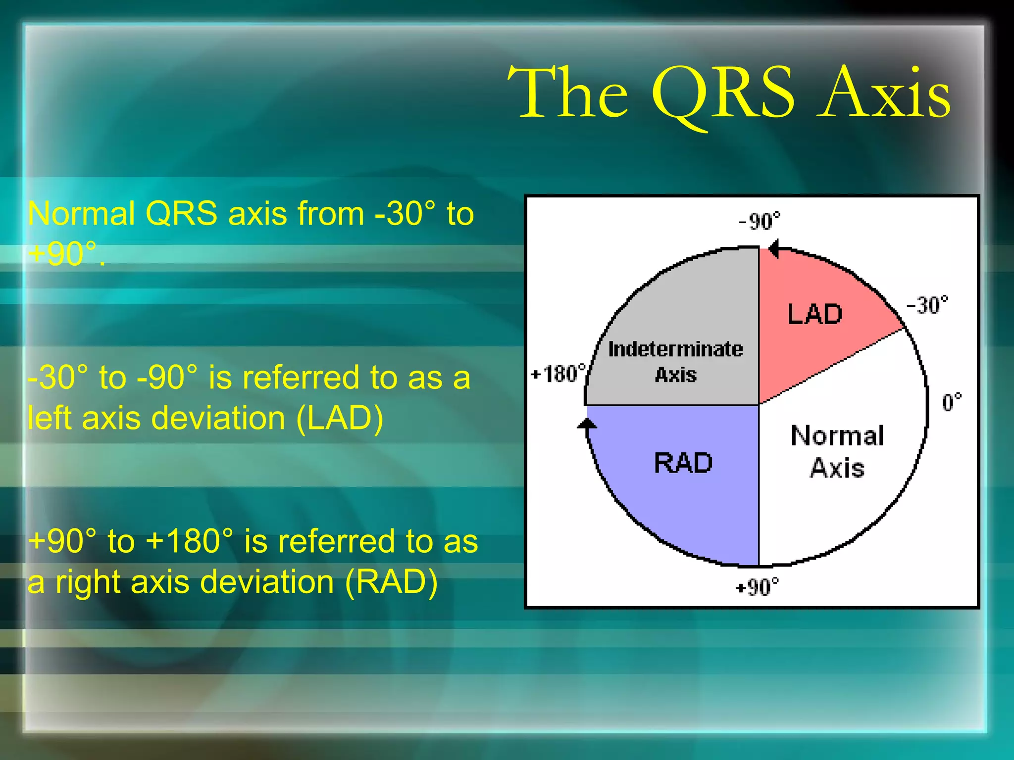 The QRS Axis Normal QRS axis from -30 °  to +90 ° . -30 °  to -90 °  is referred to as a left axis deviation (LAD) +90 °  to +180 °  is referred to as a right axis deviation (RAD) 