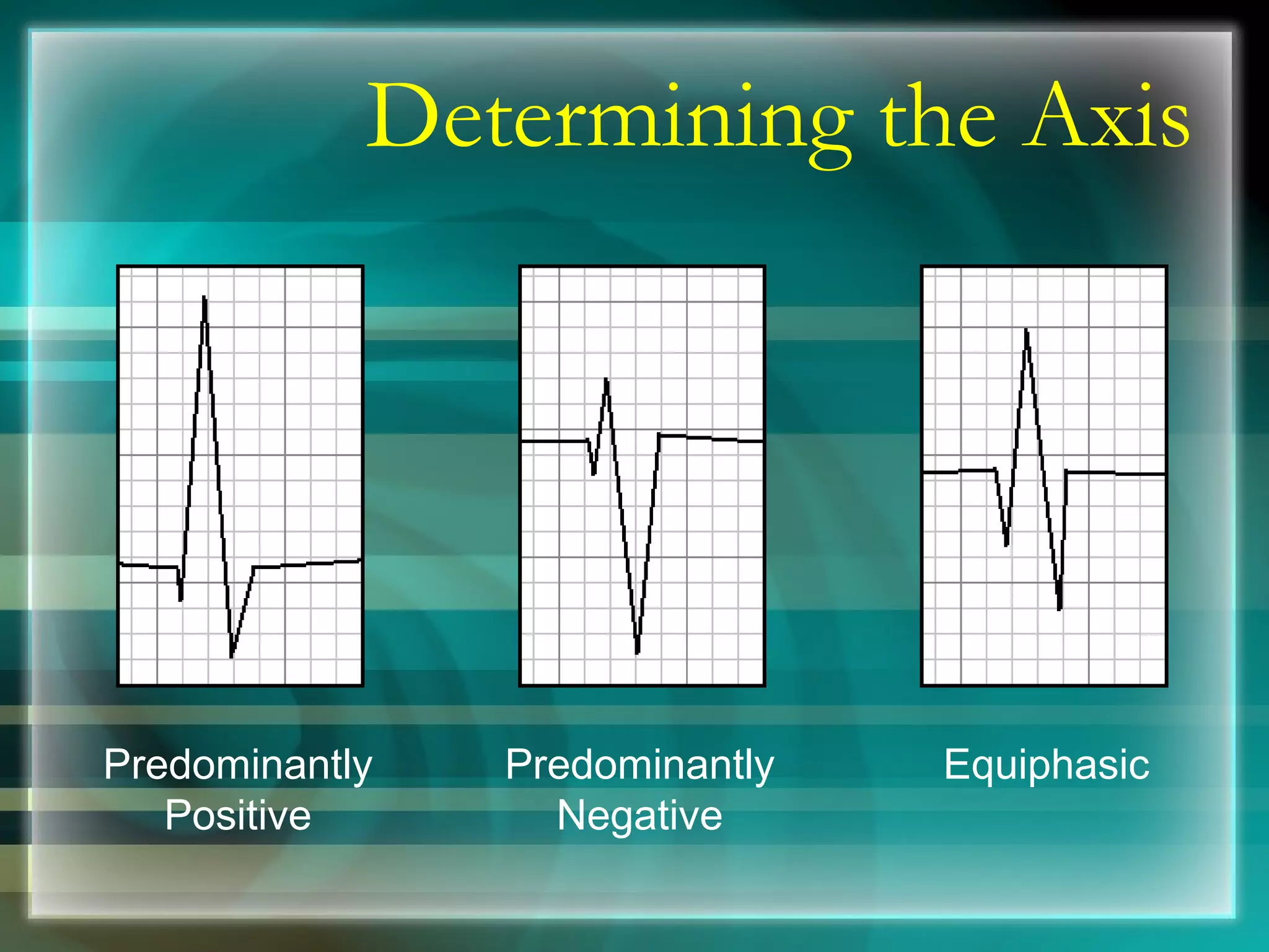 Determining the Axis Predominantly Positive Predominantly Negative Equiphasic 