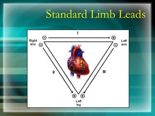 Standard Limb Leads 