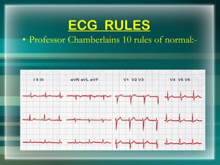   ECG  RULES <ul><li>Professor Chamberlains 10 rules of normal:- </li></ul>