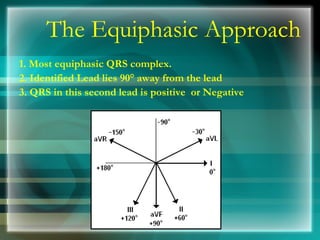 The Equiphasic Approach 1. Most equiphasic QRS complex.  2. Identified Lead lies 90° away from the lead  3. QRS in this se...
