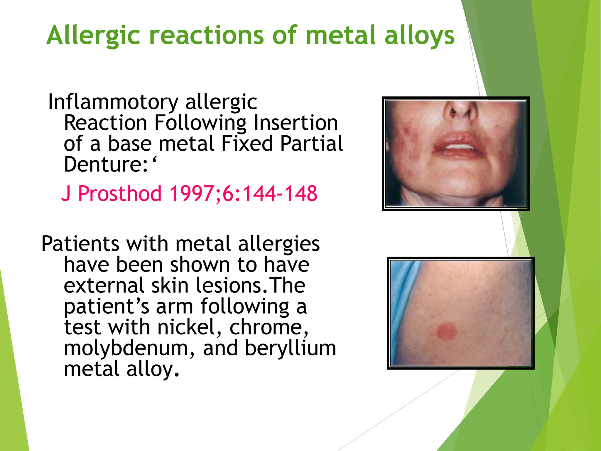 BaseMetalAlloys used in dentistry..pptx