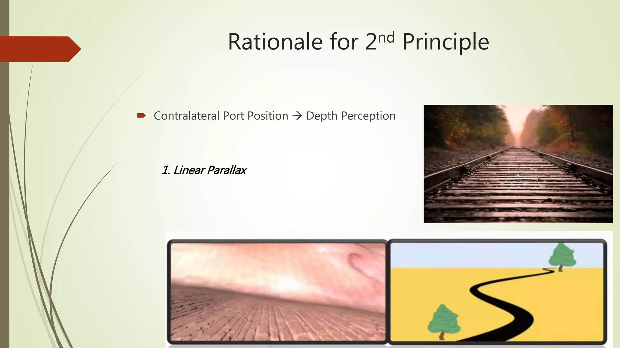 Port Position Baseball diamond concept for port position in laparoscopy | PPTX