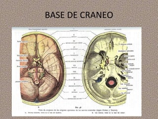 BASE DE CRANEO 