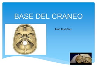 BASE DEL CRANEO
Juan José Cruz
 