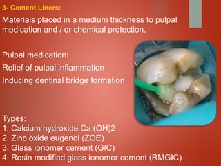 Comprehensive Overview of Cavity Liners and Bases in Dentistry | PPTX