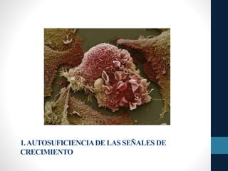 1.AUTOSUFICIENCIADE LAS SEÑALES DE
CRECIMIENTO
 