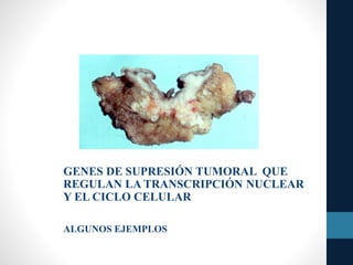GENES DE SUPRESIÓN TUMORAL QUE
REGULAN LA TRANSCRIPCIÓN NUCLEAR
Y EL CICLO CELULAR
ALGUNOS EJEMPLOS
 